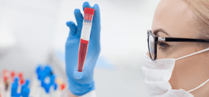 Leia mais sobre o artigo Conheça o novo exame de sangue para câncer de próstata, o PHI