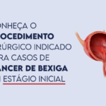 Conheça o procedimento cirúrgico indicado para casos de câncer de bexiga em estágio inicial