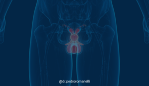 Leia mais sobre o artigo Biópsia para diagnóstico do câncer de próstata: Qual é a melhor abordagem?