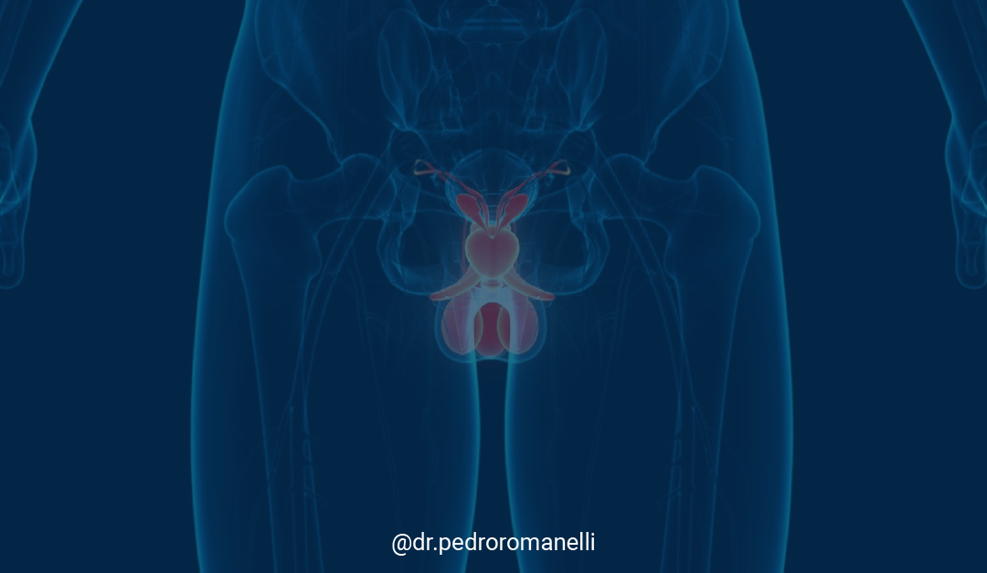 Você está visualizando atualmente Biópsia para diagnóstico do câncer de próstata: Qual é a melhor abordagem?